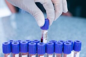 afbeelding4-post-covid